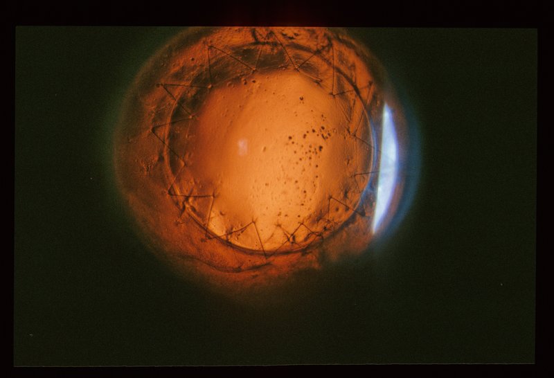 Ophthalmology 001.jpg