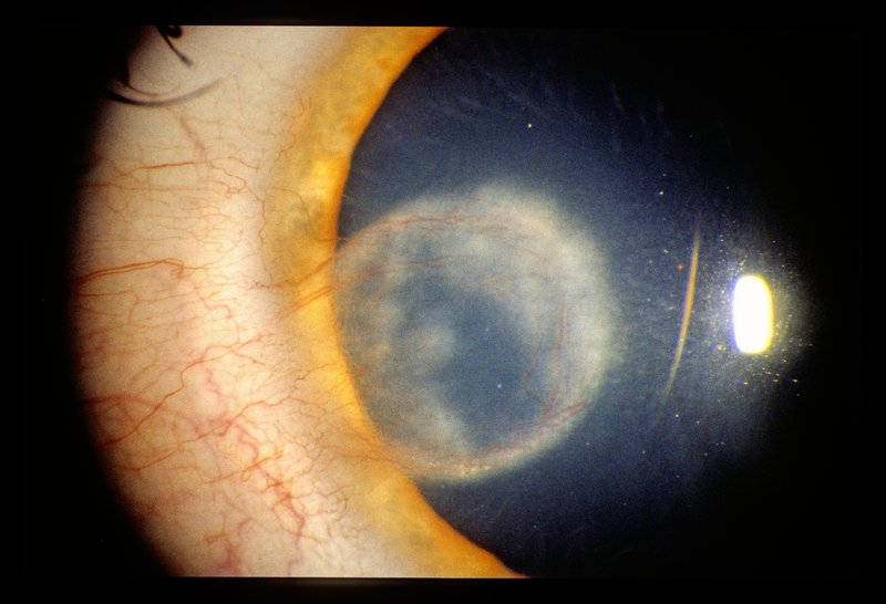 Ophthalmology 002.jpg :: (c) G.Rathert Images