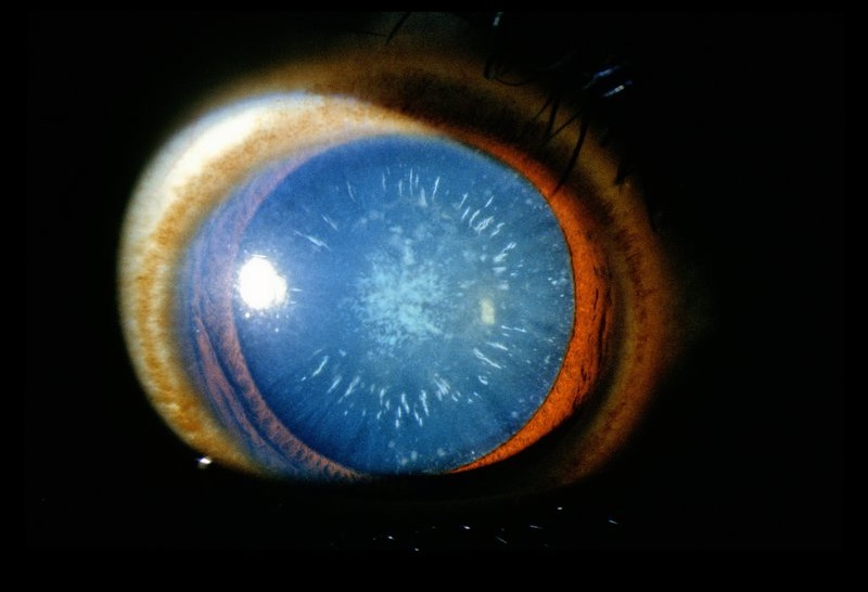 Ophthalmology 003.jpg
