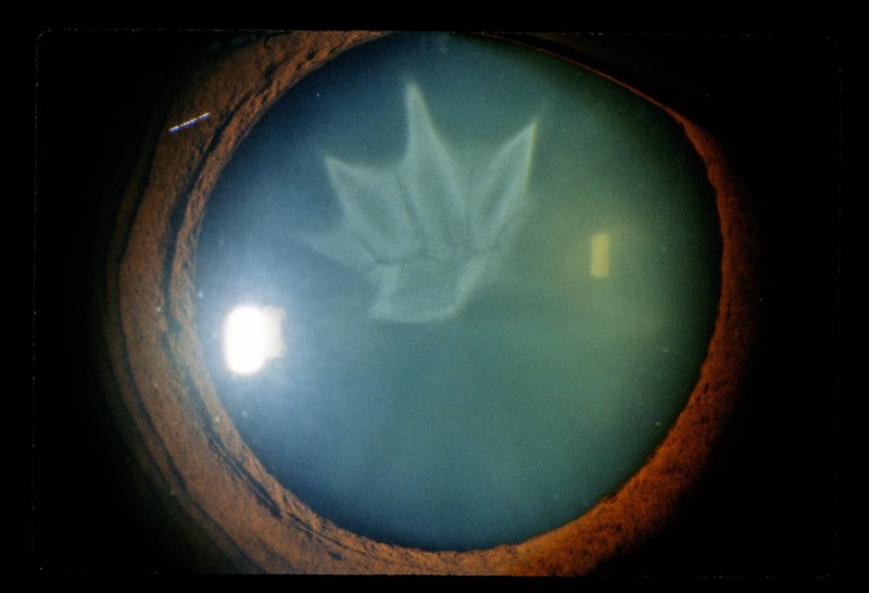 Ophthalmology 008.jpg