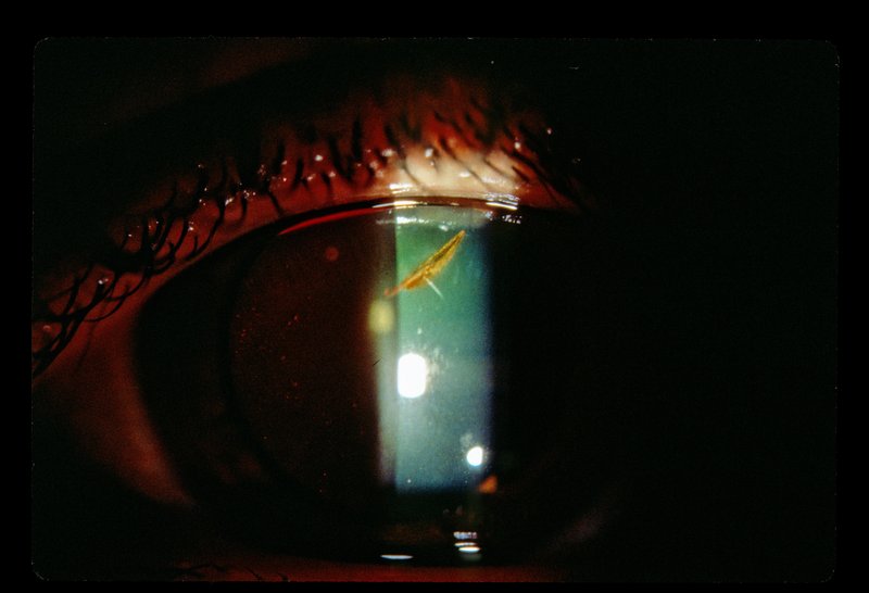 Ophthalmology 009.jpg