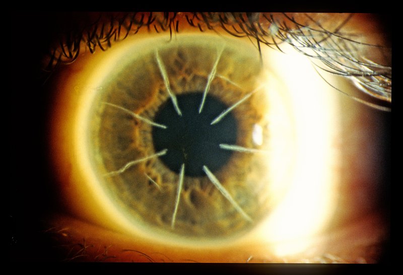 Ophthalmology 012.jpg