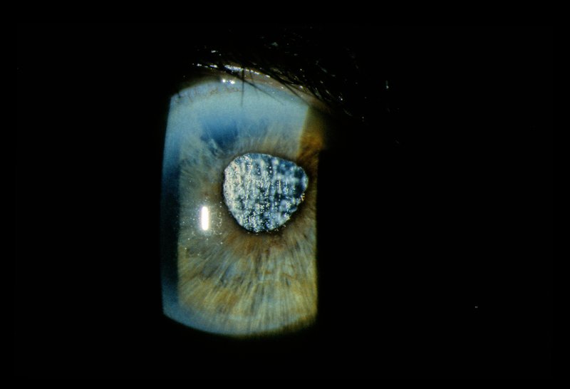 Ophthalmology 013.jpg