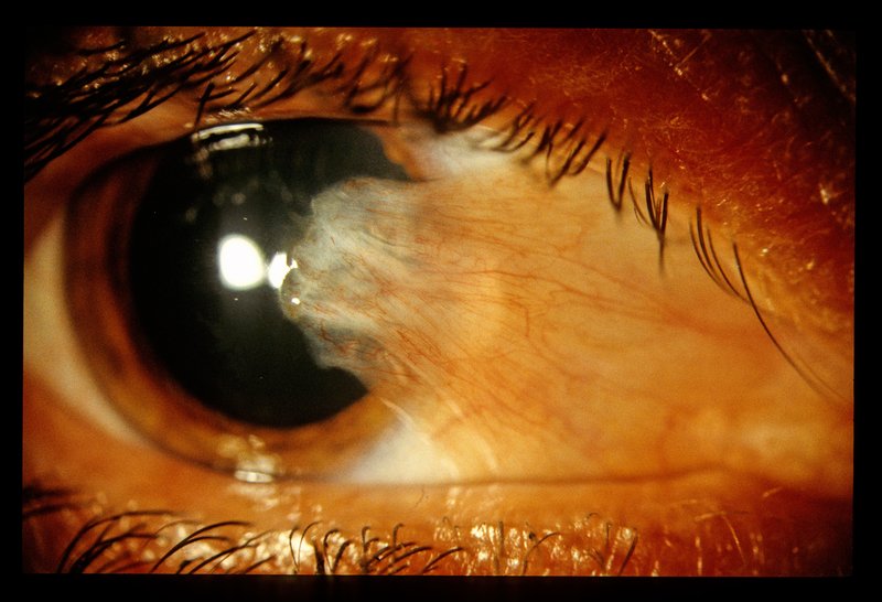 Ophthalmology 014.jpg