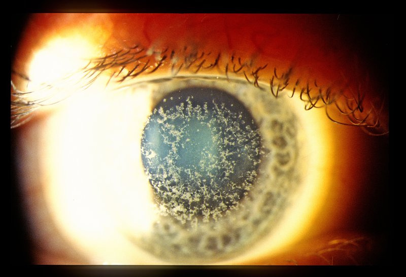 Ophthalmology 015.jpg
