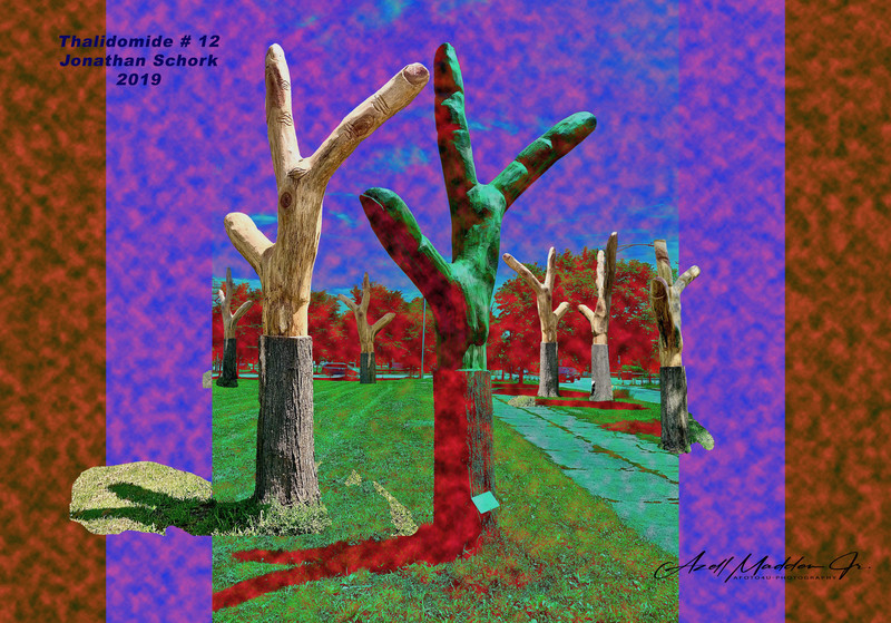 Thalidomide Jonathan Schork 2 2020  copy.jpg :: a drug formerly used as a sedative, but withdrawn in the early 1960s after it was found to cause congenital malformation or absence of limbs in children whose mothers took the drug during early pregnancy.