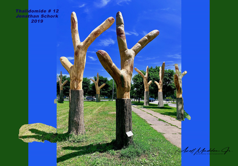 Thalidomide Jonathan Schork 2020  copy.jpg :: a drug formerly used as a sedative, but withdrawn in the early 1960s after it was found to cause congenital malformation or absence of limbs in children whose mothers took the drug during early pregnancy.