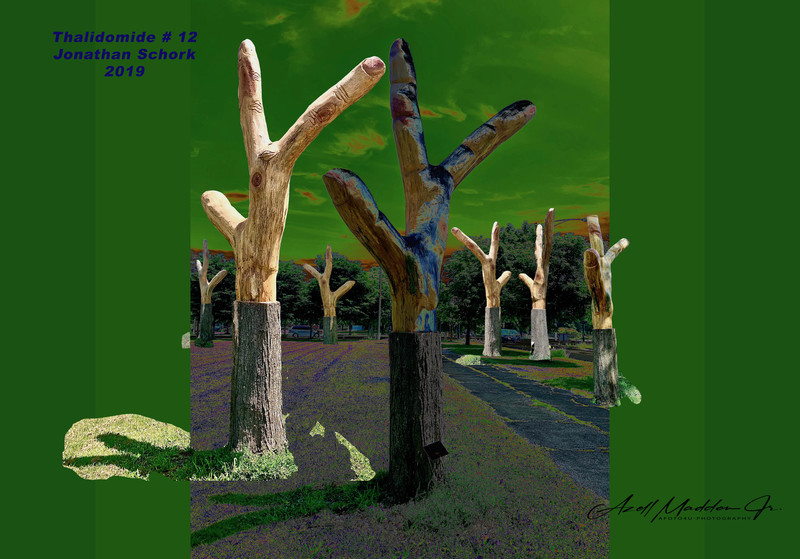 Thalidomide Jonathan Schork 3 2020  copy.jpg :: a drug formerly used as a sedative, but withdrawn in the early 1960s after it was found to cause congenital malformation or absence of limbs in children whose mothers took the drug during early pregnancy.