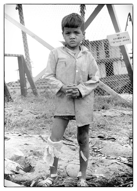 Bandaged.jpg :: I caught this young Vietnamese male child out of the corner of my eye, I noticed immediately that his legs and feet were bandaged, he looked lost and somewhat afraid. I assumed he had  a bad fall involving his legs. Some how you want to help but it is next to impossible to do so.