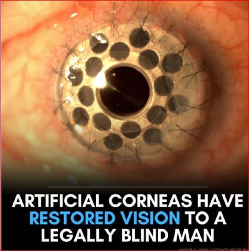 STRANGE-- MAKES THE BLIND SEE.jpg